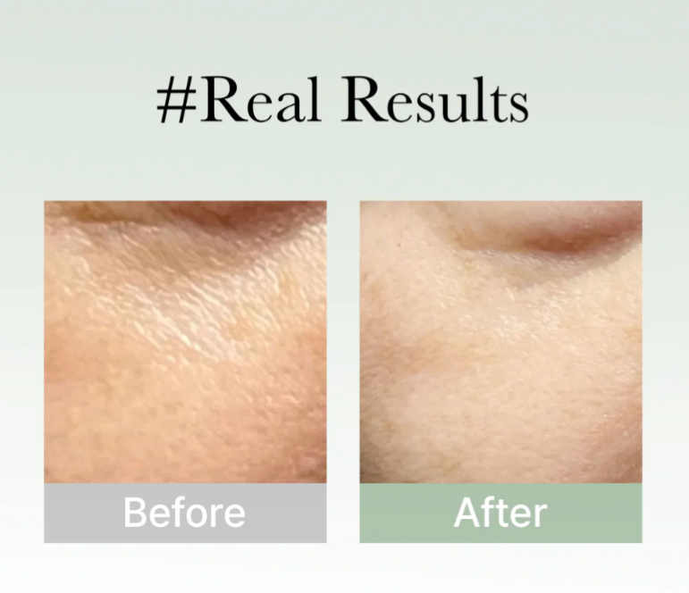 ARENCIA Hyssop Serum 30